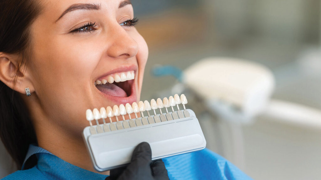 dental-veneers-oho-1024x576